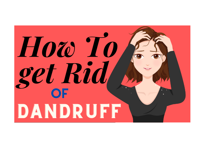 How to Get Rid of Dandruff Fast in 2023? Causes of Dandruff Couture