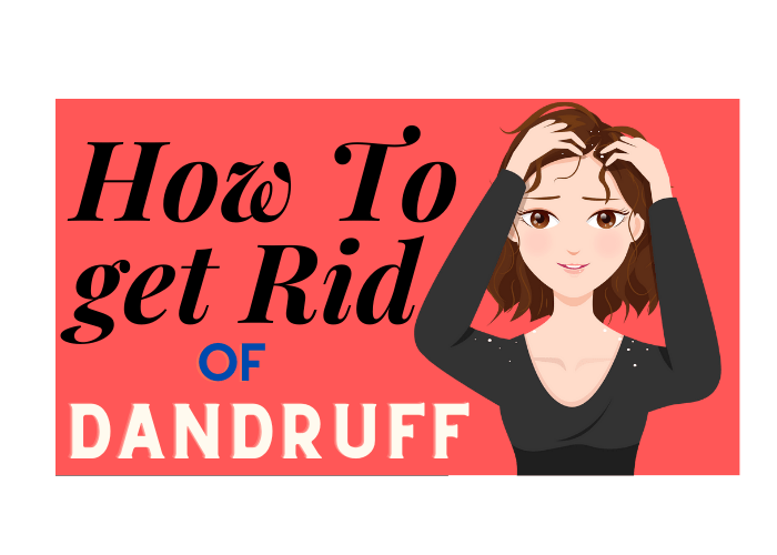 How to Get Rid of Dandruff Fast in 2023? Causes of Dandruff - Couture Hair Pro
