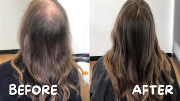 Tackle Hair Fall with a Complete Hair Care Solution - Couture Hair Pro